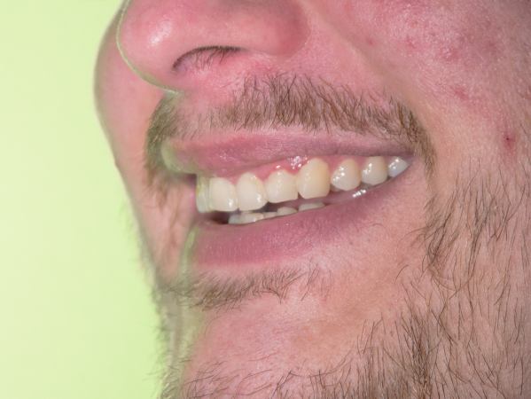 A person's mouth while they are speaking