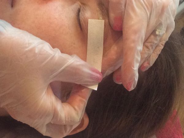 A picture of a person having eyebrow hair removed using wax